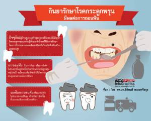 กินยารักษาโรคกระดูกพรุน มีผลต่อการถอนฟัน