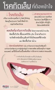 โรคกัดเล็บที่ต้องเข้าใจ