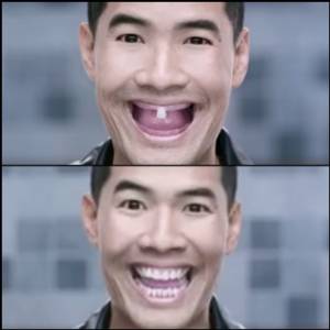 ศึกน้ำลาย! จะเชื่อ “หมอ” หรือ “โฆษณา” ยาสีฟันผสม “ฟลูออไรด์” ไม่จำเป็น?