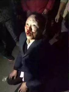 คนร้ายก่อเหตุลักพาตัวเด็กหนีไม่พ้น ถูกชาวบ้านเฉิงตูรุมสกรัมจนน่วม