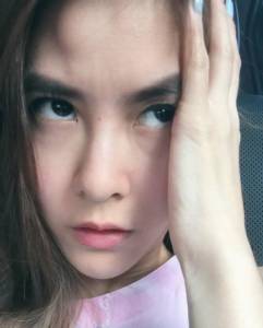 ใหญ่ขึ้น “พีค”  เปิดเหม่งโชว์กระดูกหน้าผาก