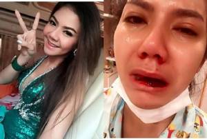 “ภูมิแพ้โพรงจมูก” จนเลือดออก “จมูก-ปาก” เกิดได้แต่น้อย