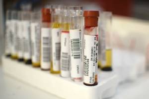 Genetic causes for high cholesterol are rare: study