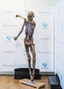 Iceman mummy