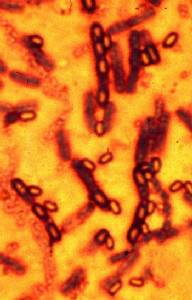 Common stomach bug costs planet $64 billion per year: study