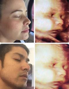 สำเนาถูกต้องเป๊ะมากลูก “แอน-ภูริ”