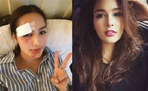 บาดเจ็บที่หน้าก็ฆ่าความสดใสสาว “แคท เซฟฟานี่” ไม่ได้