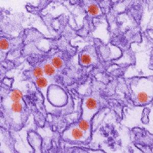 Malaysia reports first suspected Zika case
