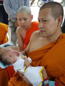 “พระบิณฑ์” ให้ 25,000 ช่วยเด็ก 8 เดือนพิการไม่มีกะโหลก-ตาบอด หลังแม่พานั่งรถจากปัตตานีร้องขอความช่วยเหลือ พร้อมวอนคนเมตตาบริจาคเพิ่ม