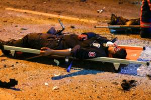ระเบิดแมตช์ที่ตุรกี!! มุ่งเป้าเล่นงาน “ตำรวจ” ไร้แฟนบอลบาดเจ็บ