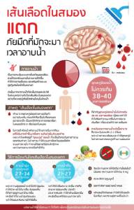 “เส้นเลือดในสมองแตก” ภัยมืดที่มักจะมาเวลาอาบน้ำ