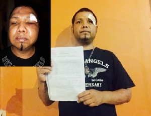 ตร.เรียกเจ้าทุกข์ให้ปากคำ แก๊ง Hells Angels ออสซี่รุมสกรัมหนุ่มพัทยา