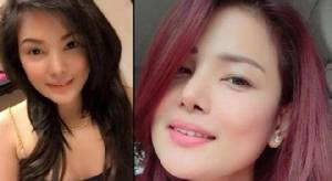 ร่างกายเกินรับไหว!? นักธุรกิจสาวสวยชาวฟิลิปปินส์ดับหลังศัลยกรรม อก, ก้น และปาก รวดเดียว