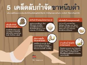 5 เคล็ดลับ กำจับขาหนีบดำ
