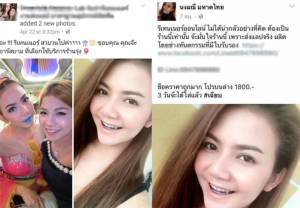 คนจัดฟันต้องรู้!! สั่งทำ “รีเทนเนอร์” ต้องออเดอร์โดยหมอฟันเท่านั้น