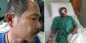 หนุ่มโรงงานถูกคนขับรถขยะ กทม.กระทืบ หวั่นคดีเงียบ เข้าพบตำรวจถามความคืบหน้า