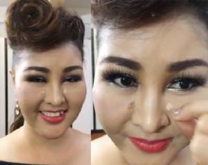 ไหวป่ะ! “หญิงลี” ทนเจ็บอวดแผลหลังผ่าตัดครั้งสุดท้าย พร้อมลุยงานต่อทันที
