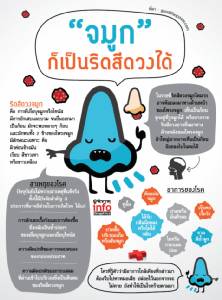 "จมูก" ก็เป็นริดสีดวงได้