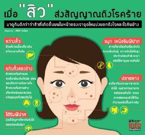 เมื่อ "สิว" ส่งสัญญาณถึงโรคร้าย