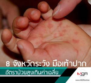 8 จังหวัดนี้ระวัง “โรคมือ เท้า ปาก” พบอัตราป่วยสูงเกินค่าเฉลี่ย