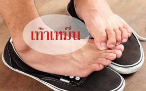 ทำอย่างไรเมื่อเท้าเหม็น