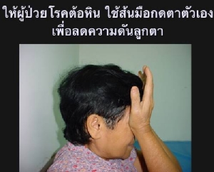 กรณีศึกษาจักษุแพทย์ไทย “ผู้ป่วย 3 ราย หายตาบอดด้วยการนวดตา” / ปานเทพ พัวพงษ์พันธ์