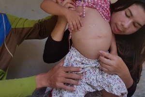 วอนช่วย “น้องซอวา” หนูน้อย 4 ขวบ มีอาการผิดปกติ ผ่าตัดท้องมาแล้ว 8 ครั้ง หมดเงินรักษา
