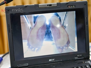เจ๋ง! นศ.วิทยาลัยเทคนิคตรัง พัฒนาสิ่งประดิษฐ์เครื่อง Podoscope เพื่อนำไปใช้กับผู้ป่วย