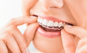 ฟันเรียงสวย ยิ้มอย่างมั่นใจ ด้วยเทคนิคจัดฟันใส
