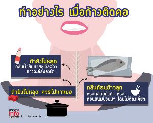 ทำอย่างไร เมื่อก้างติดคอ