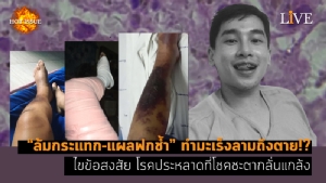 [คลิป] “ล้มกระแทก-แผลฟกช้ำ” ทำมะเร็งลามถึงตาย!? ไขข้อสงสัย โรคประหลาดที่โชคชะตากลั่นแกล้ง