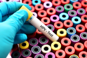 HPV ตัวการร้าย มะเร็งปากมดลูก