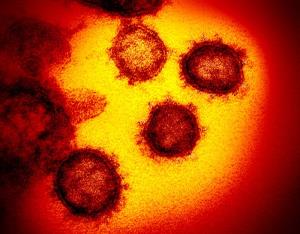 ภาพจากกล้องจุลทรรศน์อิเล็กทรอนเผยแพร่โดยสถาบันสาธารณสุขแห่งชาติสหรัฐฯเมื่อเดือน ก.พ. 2020 แสดงให้เห็น ไวรัส Novel Coronavirus SARS-CoV-2 หรือ 2019-nCoV ซึ่งเป็นไวรัสที่ทำให้เกิดโรค โควิด-19 