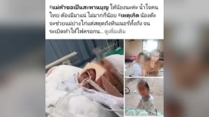 แม่สุดช้ำ! วอนช่วยเหลือลูกสาวถูกไฟคลอกทั้งตัว เผยไม่มีเงินเพียงพอค่ารักษา