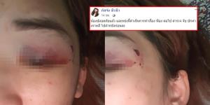 สาวไทยในเกาหลี ถูกแฟนหนุ่มทำร้ายร่างกาย-จับขังในห้อง ล่าสุดปลอดภัยแล้ว