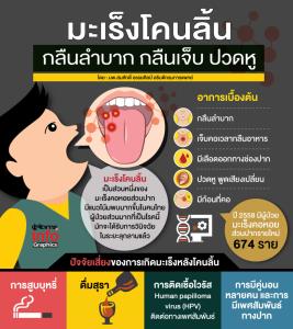 กลืนลำบาก-กลืนเจ็บ ปวดหู ระวัง "มะเร็งโคนลิ้น"