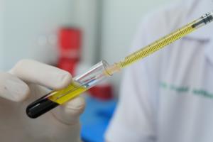 “หมอยง” เผย เตรียมศึกษาระบบภูมิต้านทาน โควิด-19 จากพลาสมาของผู้ที่หายป่วย