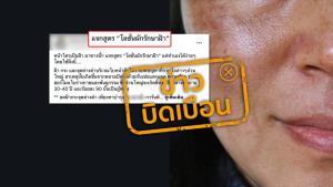 ข่าวบิดเบือน โลชั่นจากเปลือกแตงกวา-หัวไชเท้า-มะเขือเทศ-สารส้ม รักษาฝ้า