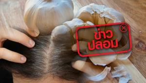 ข่าวปลอม! หมักผมด้วยกระเทียม รักษาผมร่วง