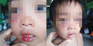 สลดใจ! สาวเจอหนูน้อย พ่อแม่แยกทางกัน อาศัยอยู่กับพ่อ-แม่เลี้ยง พบมีรอยช้ำตามตัว
