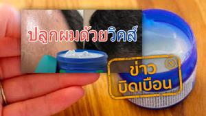 ข่าวบิดเบือน! ปลูกผมด้วยวิคส์ ไม่มีผลต่อการงอกของเส้นผม