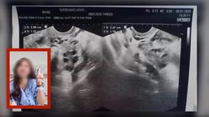 อุทาหรณ์! สาวป่วยมะเร็งปากมดลูก ระบุ อาการตกขาวกลิ่นแรง ควรรีบพบแพทย์