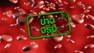 ข่าวจริง! หลอดเลือดแดงอุดตันจากแคลเซียมเกาะผนังหลอดเลือด