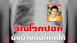 แพทย์ยัน “วัณโรคปอด” อันตรายมาก เพียงนั่งใกล้ก็สามารถติดโรคได้