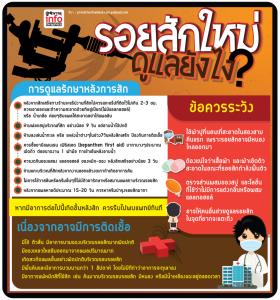 รอยสักใหม่ ดูแลยังไง?