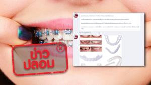 ข่าวปลอม! เครื่องจัดฟันซิลิโคน สามารถใช้จัดฟันเองได้ โดยไม่ต้องไปพบแพทย์