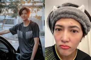 โดนเต็มหน้า!!! "ปลื้มจิตร์" ได้เลือดก่อนลุยลูกยางเนชั่นส์ลีก