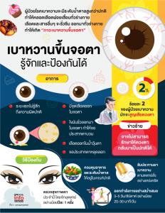 เบาหวานขึ้นจอตา : รู้จักและป้องกันได้