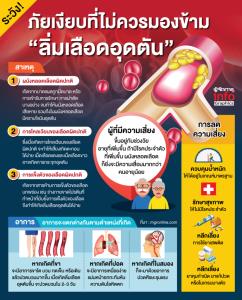 ภาวะลิ่มเลือดอุดตัน ภัยเงียบที่ไม่ควรมองข้าม