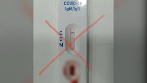 สังเกตให้ดี! “หมอแล็บ” แนะชุดตรวจโควิดควรเป็นชนิด “Rapid Antigen Test” ชี้แบบอื่นยังไม่อนุญาตให้ตรวจเอง